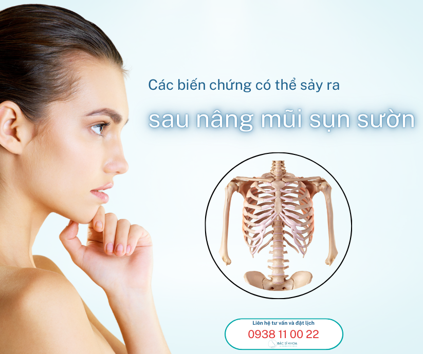 biến chứng sau nâng mũi sụn sườn