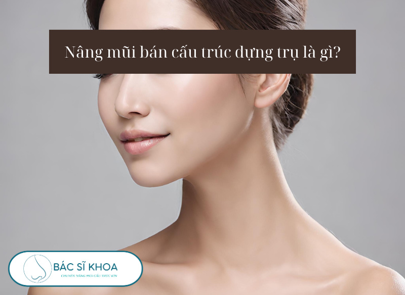 Nâng mũi bán cấu trúc dựng trụ là gì?