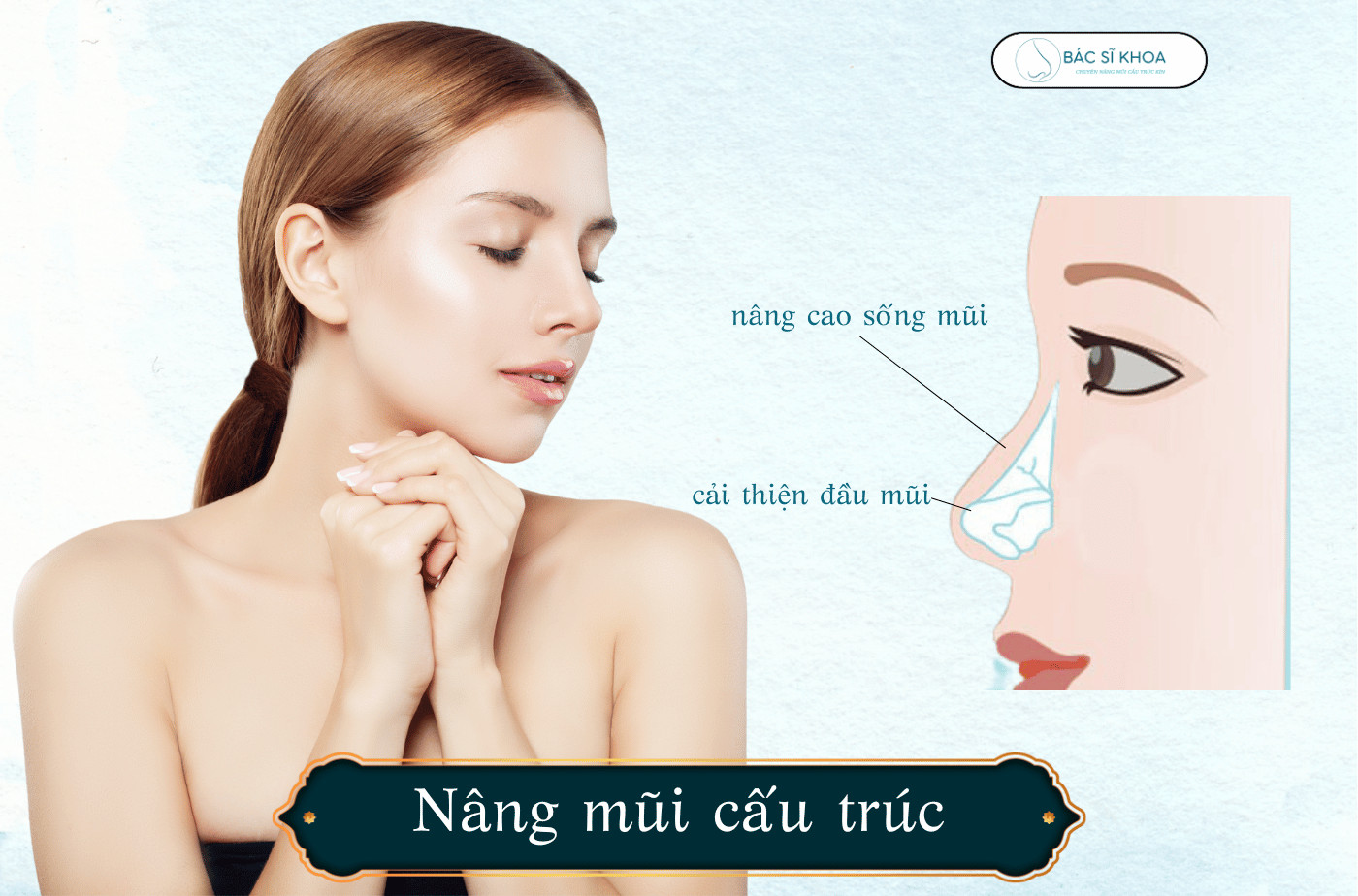 Nên lựa chọn sụn nâng mũi nào