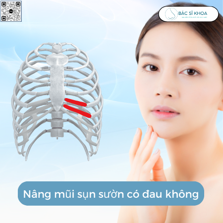 nâng mũi sụn sườn có đau không