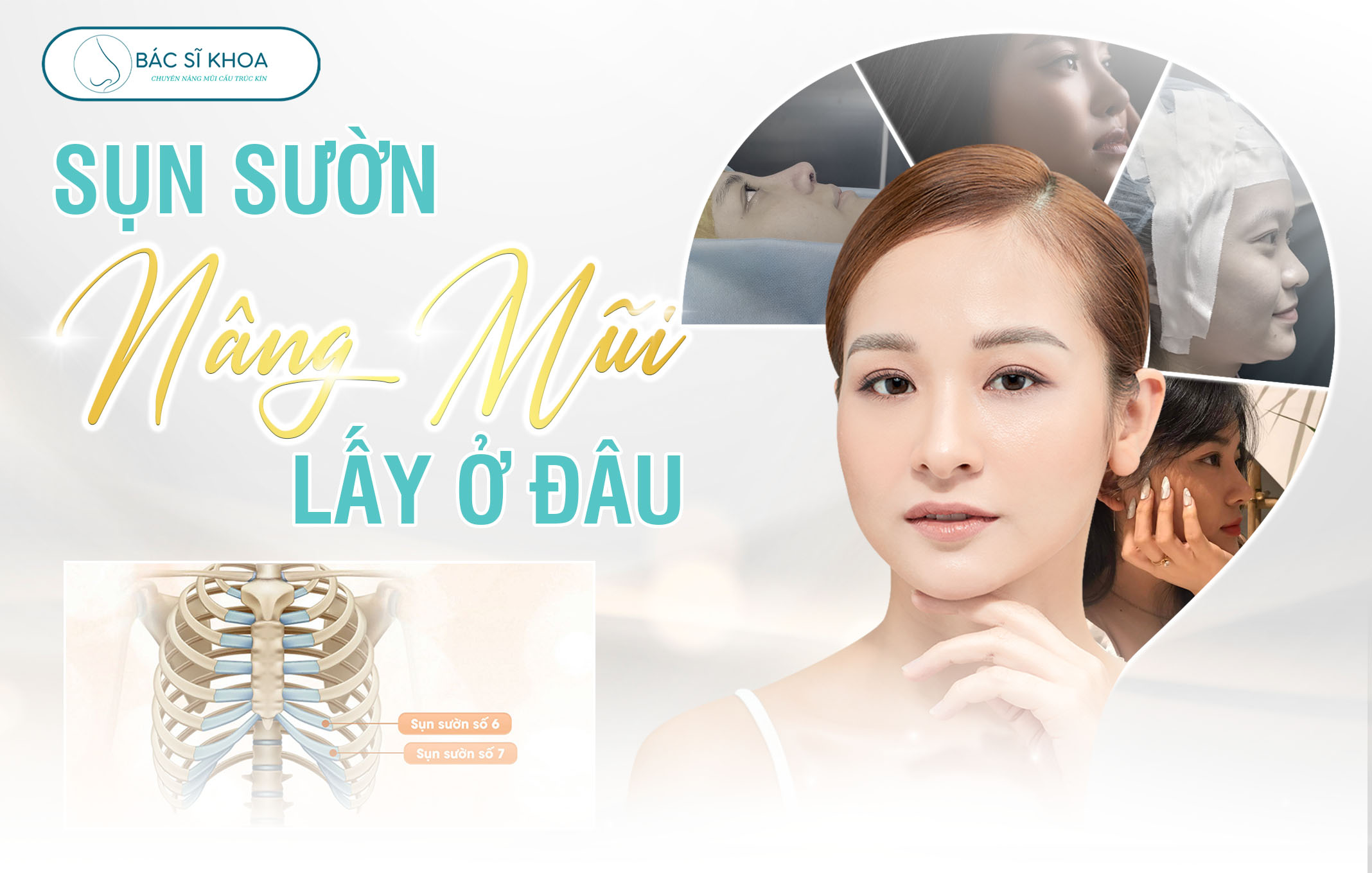 nâng mũi sụn sườn lấy ở đâu