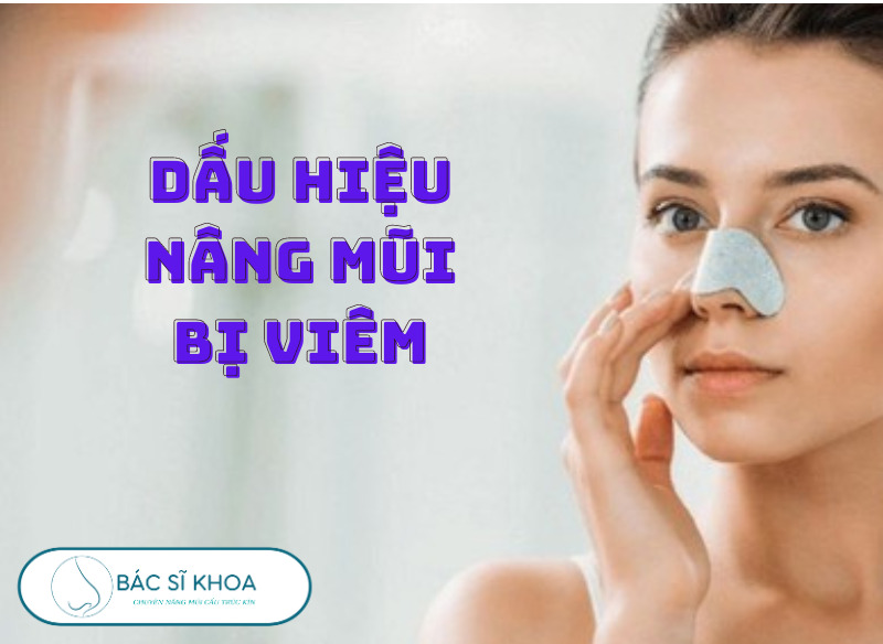 Dấu hiệu nâng mũi bị viêm